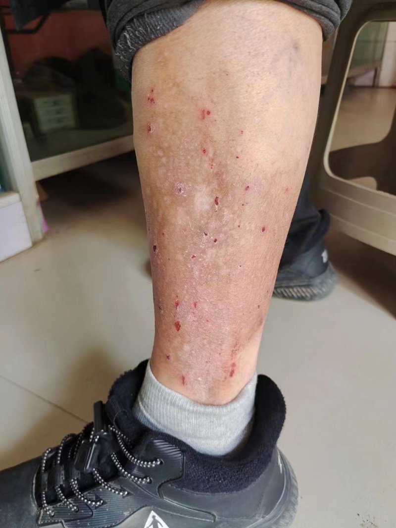 邢台皮肤医院:守护美丽与健康的前沿阵地