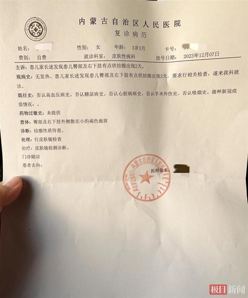 牛皮癣:从困扰到治愈的故事